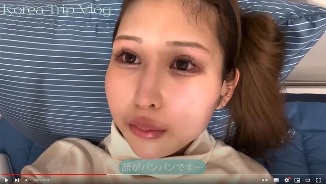 施術直後の浦西ひかるさん。YouTubeチャンネル「おたひかのひかるです」より